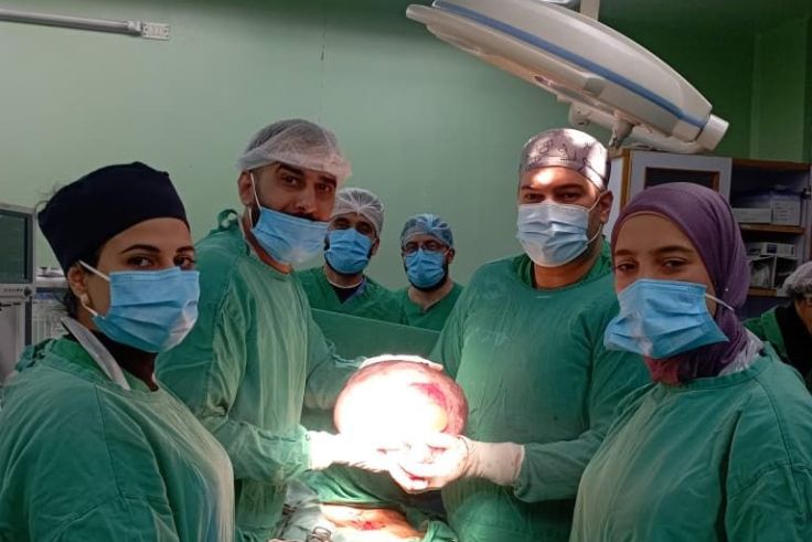 استئصال كيسة مبيض 